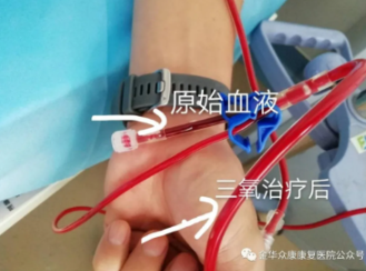 秋天腦血管疾病高發(fā)期，做對一件事就高枕無憂了
